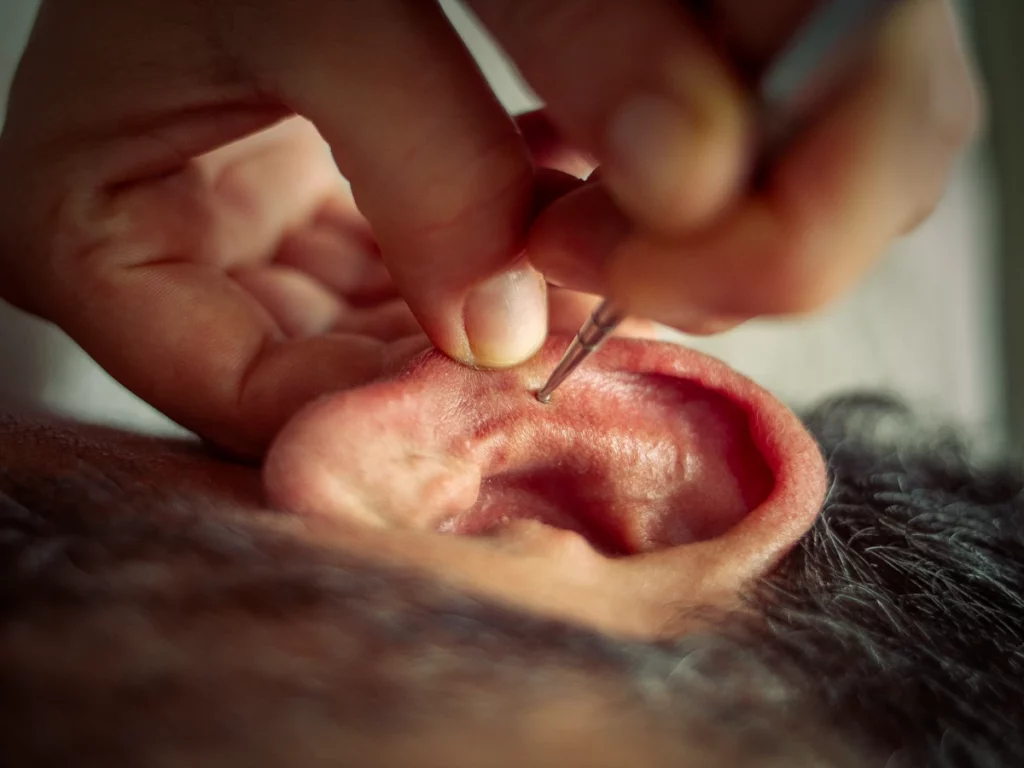 mariane derancy praticienne santée naturelle auriculothérapie